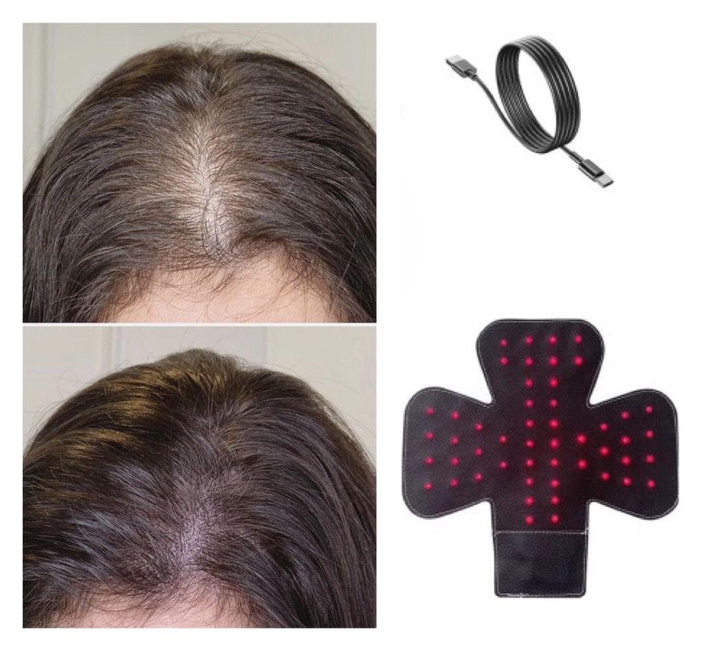 Dispozitiv Laser cu Infrarosu pentru Regenerarea si Prevenirea Caderii Parului Dispozitiv Laser cu Infrarosu pentru Regenerarea si Prevenirea Caderii Parului