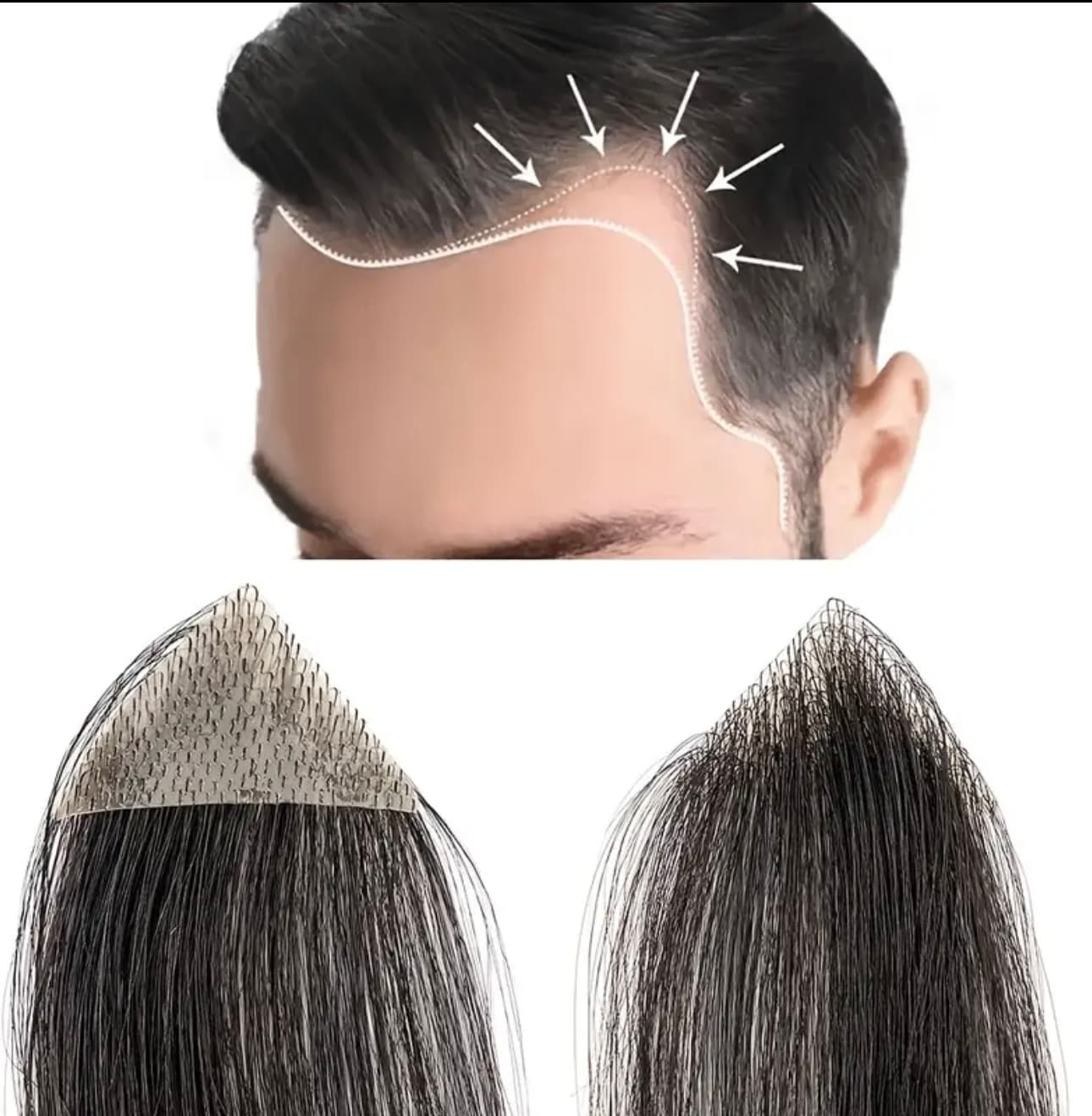 Mesa Adeziva pentru Alopecie Mesa Adeziva pentru Alopecie